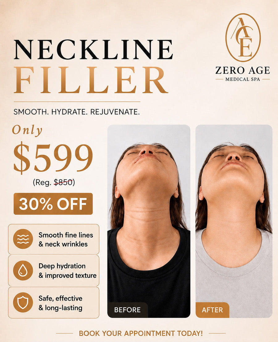 Neckline filler before and after results smoothing neck lines and wrinkles, only $599 (30% off) at Zero Age MedSpa, Katy & Houston