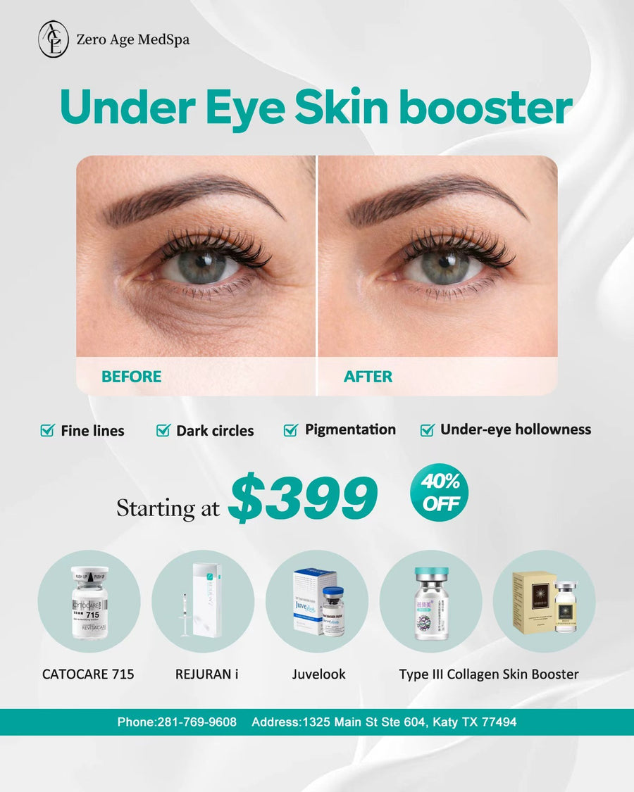 Under-eye rejuvenation before and after treating dark circles, fine lines and hollowness, from $399 (40% off original price) at Zero Age MedSpa in Katy & Houston