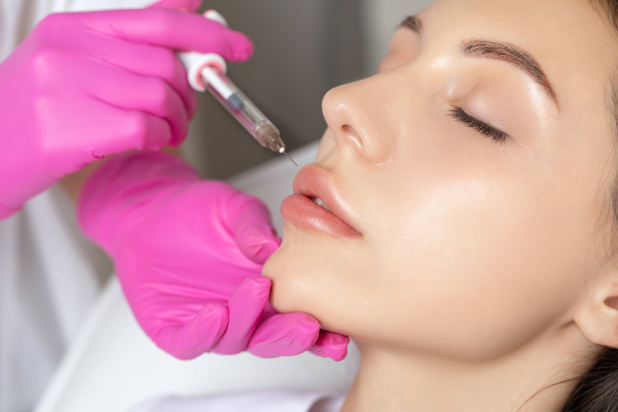 Dermal fillers at Zero Age MedSpa in Katy & Houston, TX