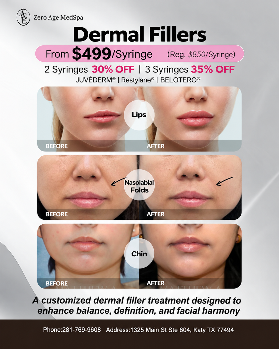 Dermal filler before and after results for lips, nasolabial folds & chin from $499/syringe at Zero Age MedSpa, Katy & Houston