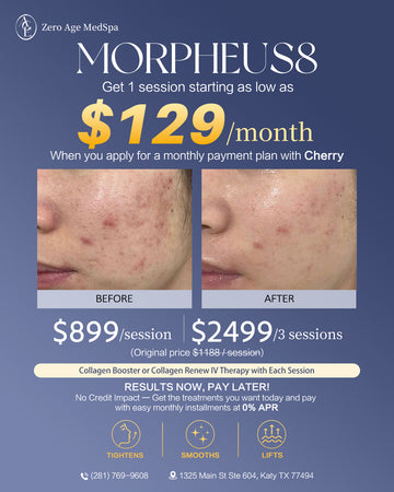 Morpheus8 RF microneedling before and after acne scar results, $899/session with financing from $129/month at Zero Age MedSpa, Katy & Houston