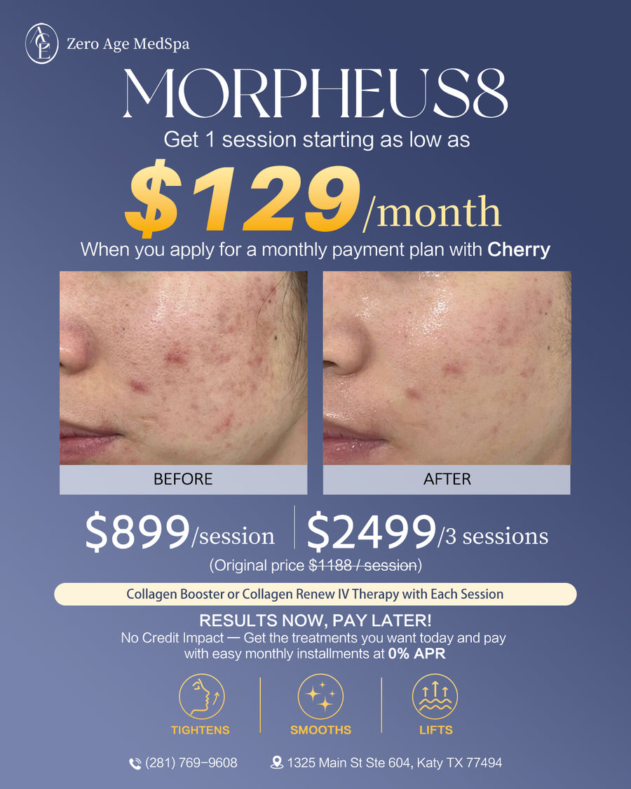Morpheus8 RF microneedling before and after acne scar results, $899/session with financing from $129/month at Zero Age MedSpa, Katy & Houston
