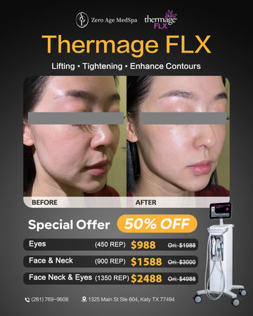 Thermage FLX before and after facial results with 50% off pricing for eyes, face & neck at Zero Age MedSpa, Katy & Houston