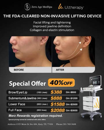 Ultherapy PRIME before and after jawline lifting results with 40% off pricing for brow, eye, jawline and full face at Zero Age MedSpa, Katy & Houston
