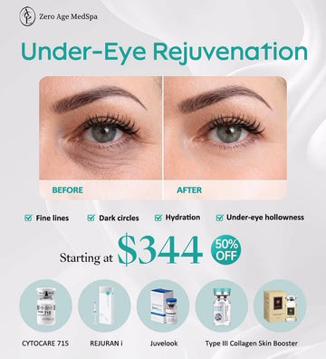 Under-eye rejuvenation before and after treating dark circles, fine lines and hollowness, from $344 at Zero Age MedSpa in Katy & Houston